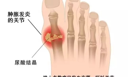 病人生病只吃稀饭和稀饭-生病人喝放盐稀饭好网 - 网站提供生病了喝盐水还是开水小常识、生病中吃白粥放盐吗